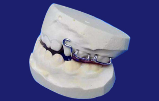 牙颌垫牵引器2.jpg